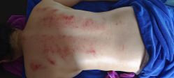 点击看大图 -蓝丝带产后恢复中心·催乳·通乳(九龙坡香榭里店)