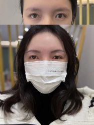 -Doris多里斯半永久纹眉·SMP纹发·发际线