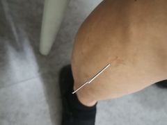 -悦和堂中医门诊部·疼痛调理·针灸推拿·艾灸拔罐
