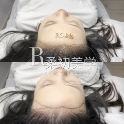 -RC半永久纹眉纹发际线
