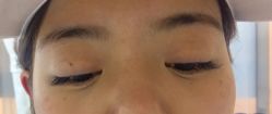 -AKI SKIN翊美芝科技美容