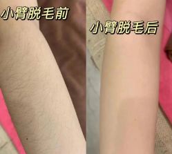 -咪咪比基尼脱毛专业店