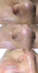 -MLP美丽派·问题肌疗愈中心
