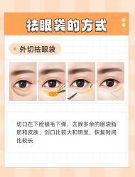 -广州健丽·去眼袋医疗美容机构