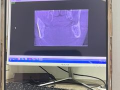 -土豆口腔(凤凰北总店)