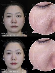 点击看大图 -Yestar重庆艺星医疗美容医院