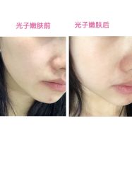 -慕颜医疗美容·皮肤微整 抗衰