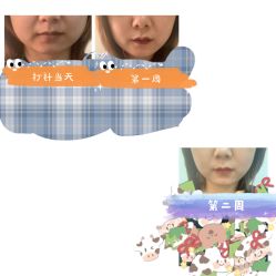 体验前-美莱医学美容医院