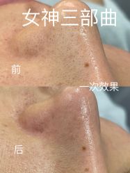 -skin79皮肤管理中心