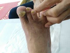 -郑远元专业修脚房(栖山路店)