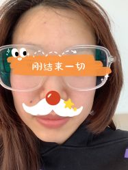 体验后-纯粹医美