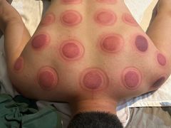 -创新足专业修脚(龙荷路店)