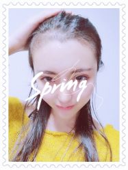 体验后-大麦微针植发全国连锁