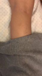 -肥三针腧穴瘦身馆