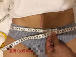 -百佳医疗级月子会所