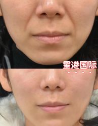 -星港国际·Skin皮肤专研·皮肤管理