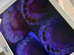-爱牙联合口腔(门诊报销 海云庵店)