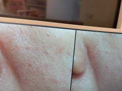 -苑苑vbeauty科技美容SPA