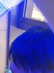 -碧莲盛·不剃发植发