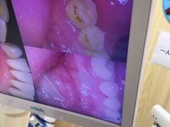 -爱牙联合口腔(门诊报销 海云庵店)