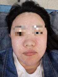 -More摩尔医美の注射线雕光电中心