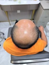 点击看大图 -唐风采假发补发定制