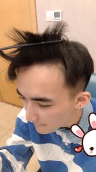 点击看大图 -大麦微针植发丨全国连锁