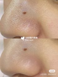 -中科妍美专业脱毛美肤连锁机构