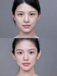 -深圳艺星医疗美容医院