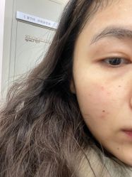 体验前-上海首尔丽格医疗美容医院