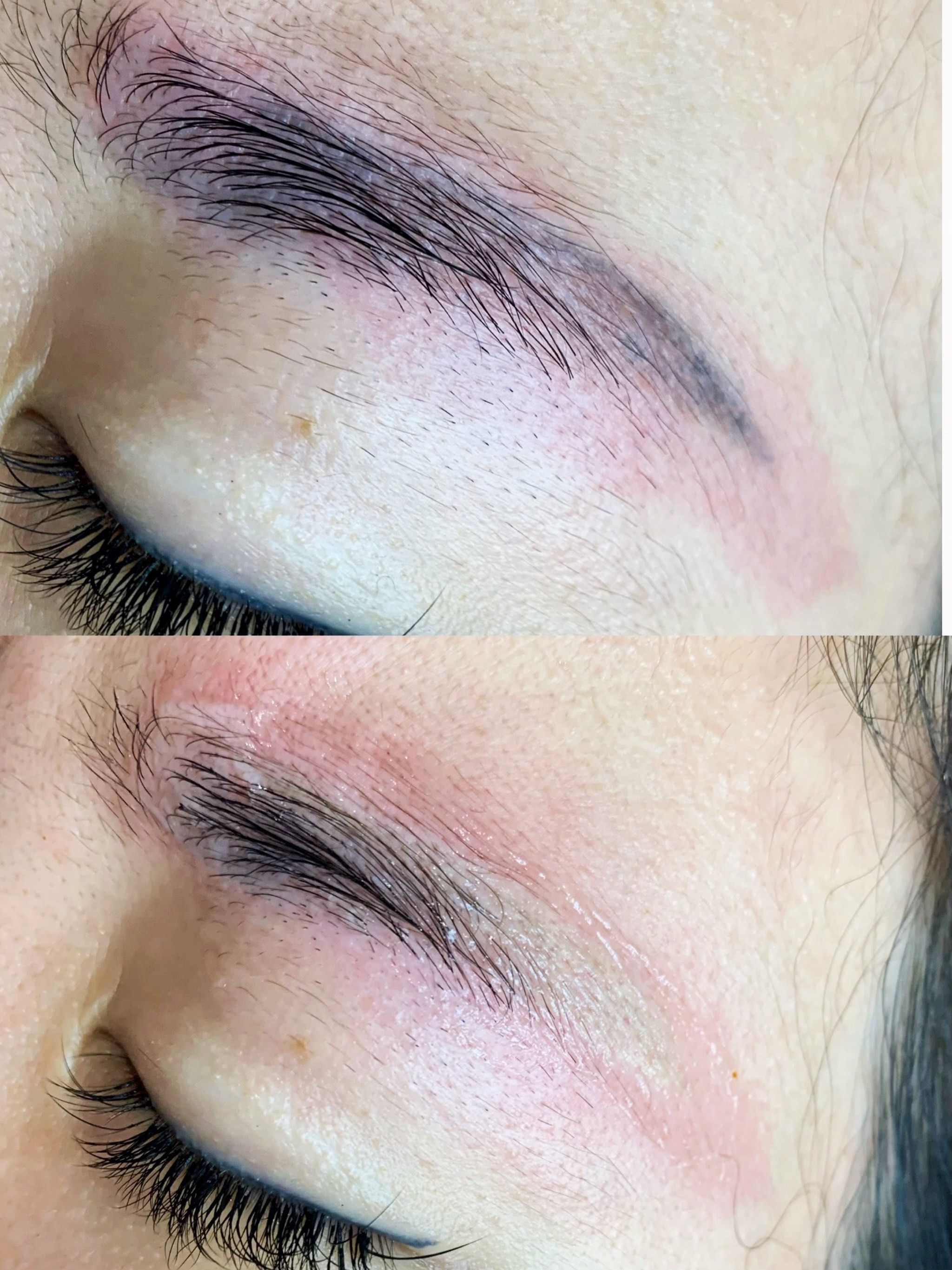 黑科技无创洗眉