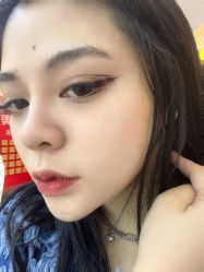体验后-青岛诺德医学美容医院