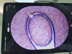 点击看大图 -凡碧诗毛孔清洁收细