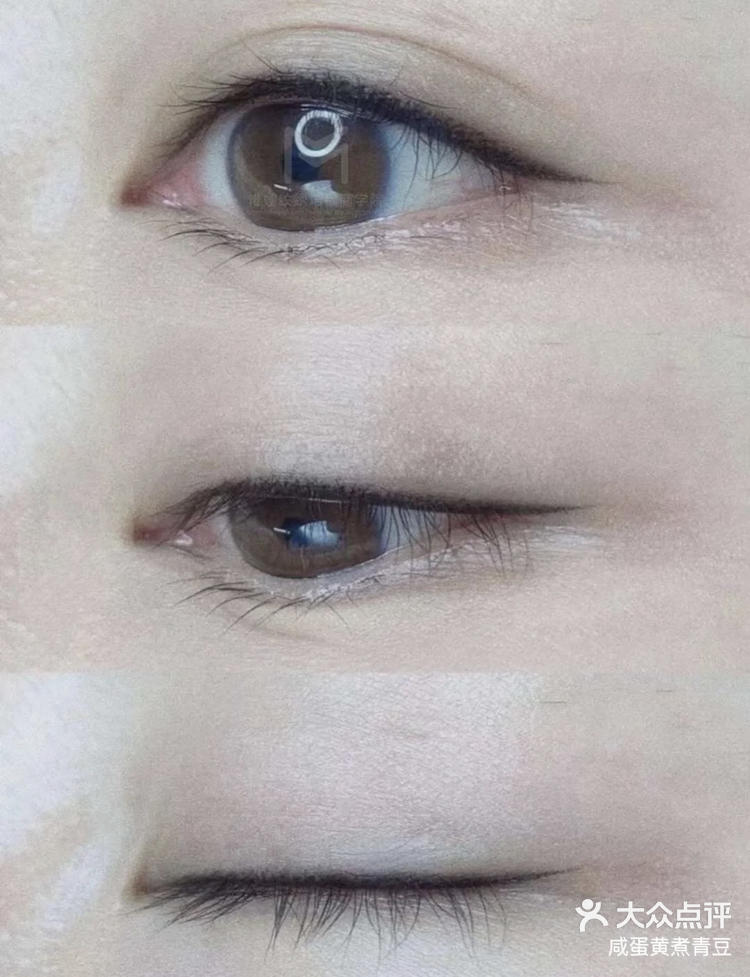 北京半永久沙雾眼线