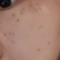 点击看大图 体验后-BR光电保养