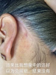 -清疣美疣·痣·斑净肤中心