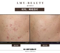 -丽美妍医疗美容·皮秒·立体分层抗衰