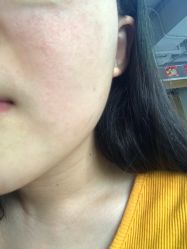 -深圳阳光医疗美容医院·旗舰店