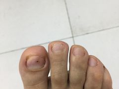 -新甲连锁灰指甲·甲沟炎·鸡眼(黑龙江路店)