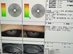 -大连何氏眼科医院