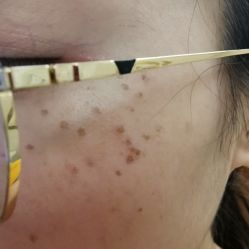点击看大图 体验后-天津伊美尔医疗整形美容专科医院