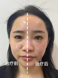 -Yestar杭州艺星医疗美容医院
