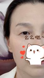 -德绣·机器野生眉发际线·美瞳线半永久