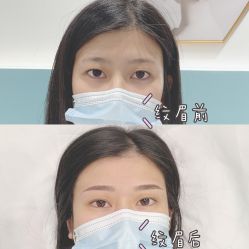 -久匠半永久纹眉