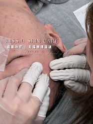 -KISS U 国际美学