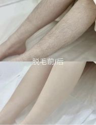 -薇兰专业脱毛连锁机构