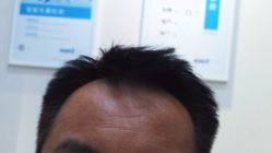 -雍禾植发全国连锁