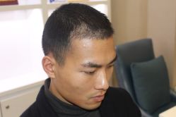 -大麦微针植发丨全国连锁