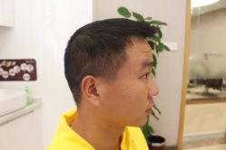 点击看大图 -大麦微针植发丨全国连锁