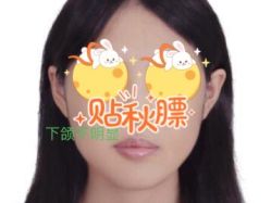 体验前-紫洁俪方（北京）医疗美容